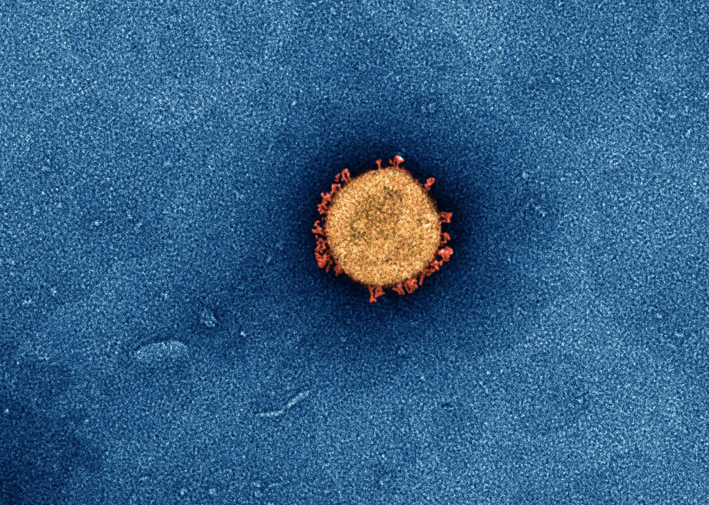 Microscopic image of a virus